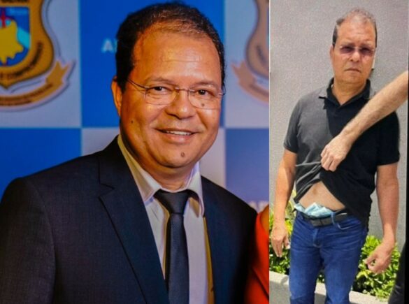 renildo-3-